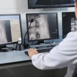 Doctor looking at digital x-rays on a computer monitor