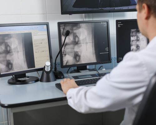 Doctor looking at digital x-rays on a computer monitor
